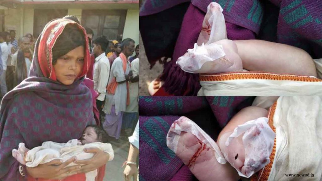 Horrific! Infant dies of rat bite in NICU at DMCH Darbhanga, alleges parents