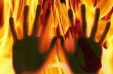 UP: Woman sets husband ablaze for having dark complexion