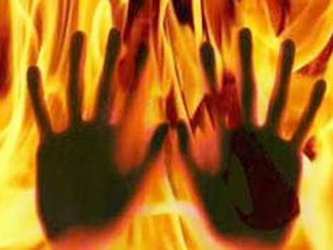 UP: Woman sets husband ablaze for having dark complexion