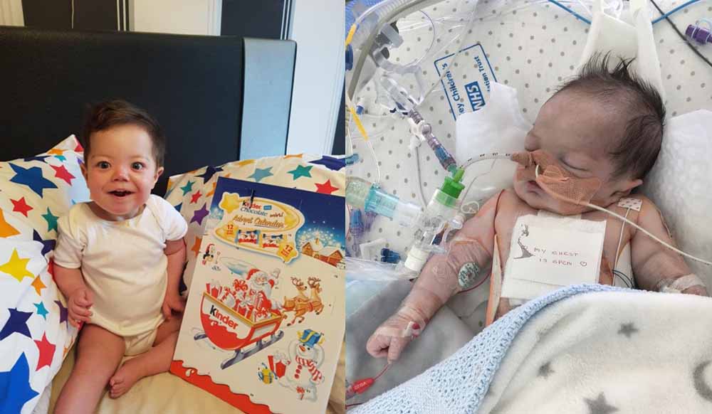 UK: Superbaby survives 25 heart attacks in one day