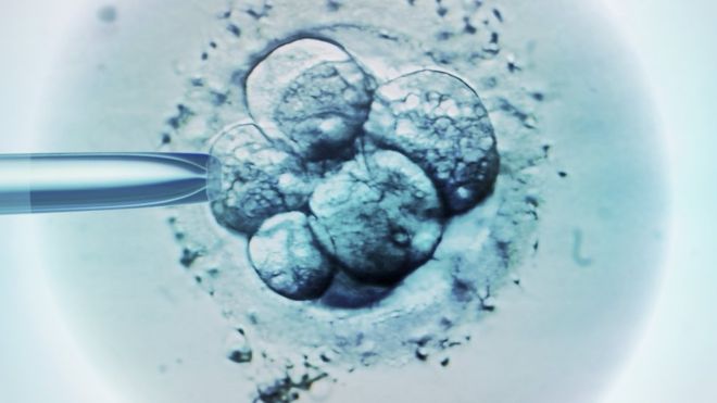 Man arrested for attempting to smuggle live human embryo to India