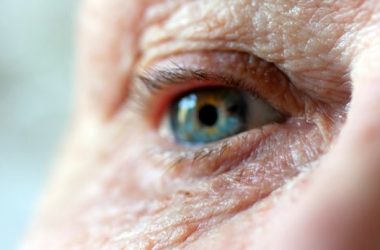 Eye check-up to detect Alzheimer's disease