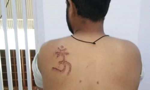 Om symbol engraved on shoulder of Muslim Tihar inmate; Delhi court orders enquiry