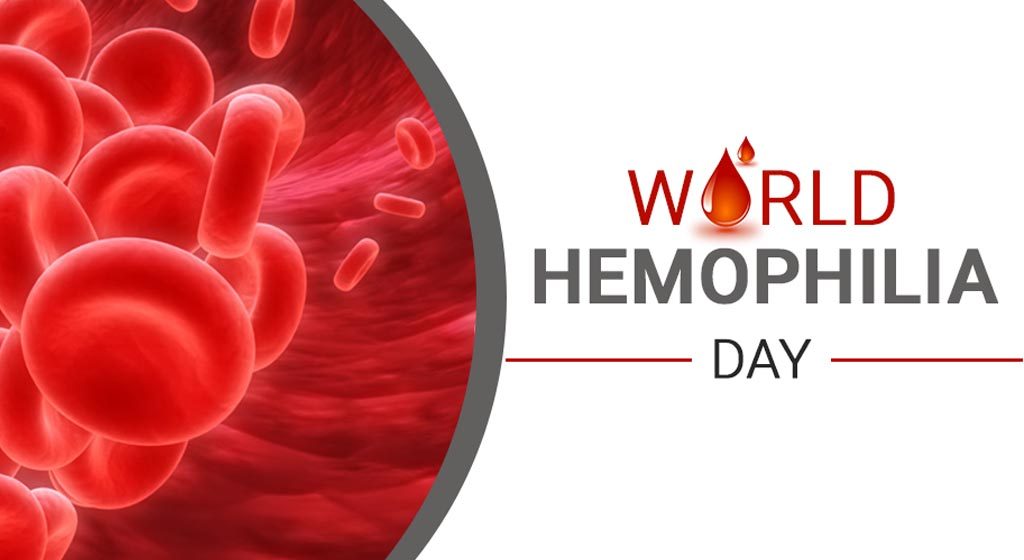 World Hemophilia Day 2019: Theme, History and Significance of the day on bleeding disorder