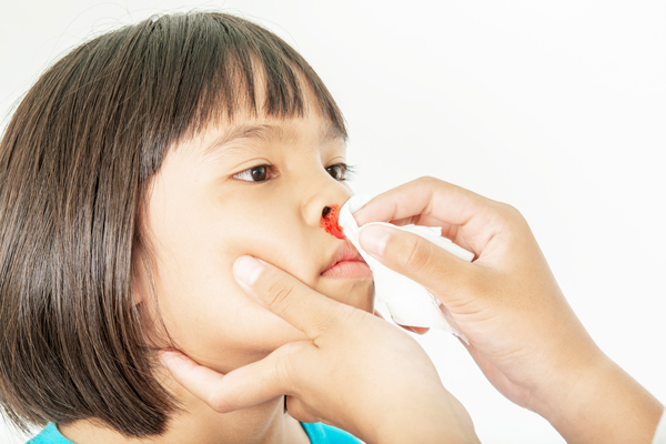Here’s why people suffer from nosebleed during summers, ways to stop it
