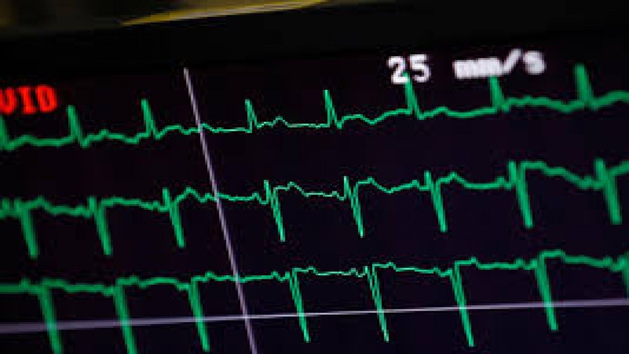 Artificial intelligence can beat doctors in predicting heart attack