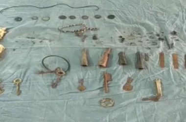 Rajasthan: Doctors remove keys, coins and metal items from man’s stomach