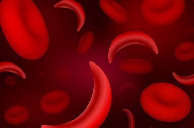 World Sickle Cell Day 2019: Theme, significance of the day for raising awareness about genetic disease