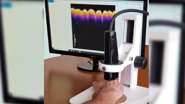'Virtual biopsy' device to help detect skin tumours