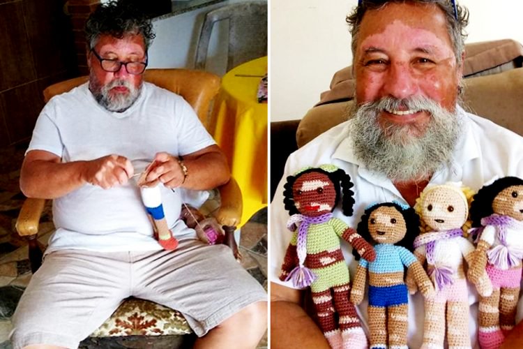 Man with vitiligo knits dolls with same face condition to boost children’s confidence
