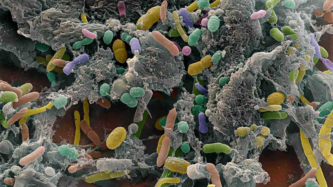 New technique for early detection of foodborne bacteria: Study