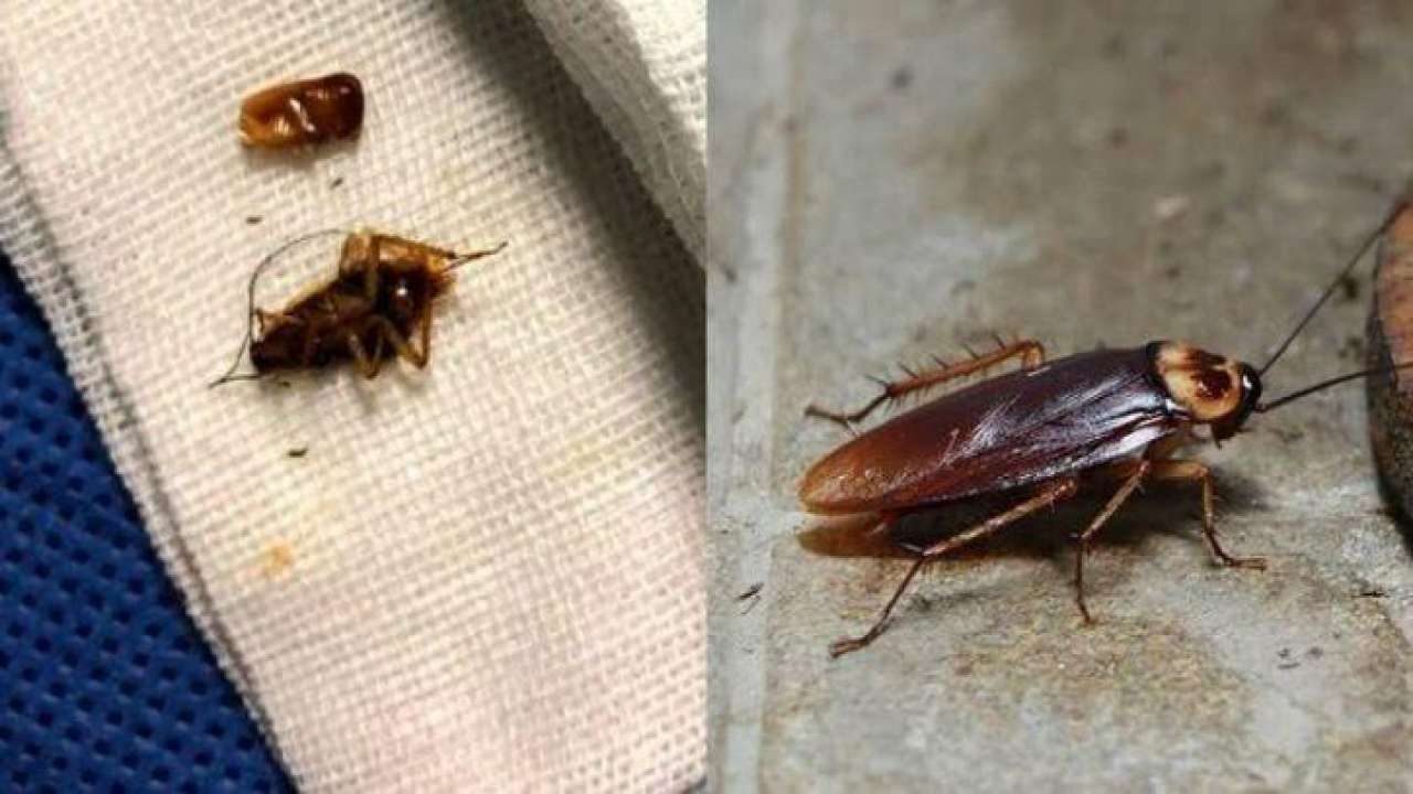 Cockroaches found living inside Chinese man's ear
