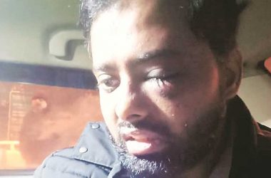 CAA protest: Jamia student loses one eye during alleged police action
