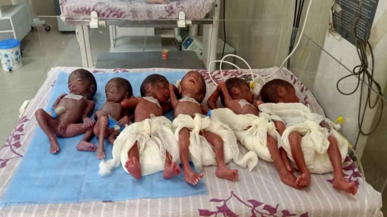 Madhya Pradesh woman gives birth to 6 babies; 2 die