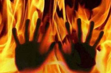 Hyderabad: Man sets son ablaze over getting beedis late