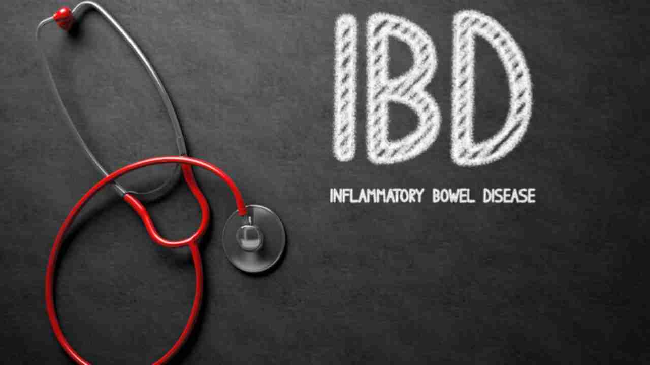 Inflammatory bowel disease linked to adverse pregnancy outcomes