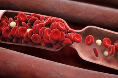 Doctors tensed after thick blood clots in kidneys, lungs and brains of Covid-19 patients detected