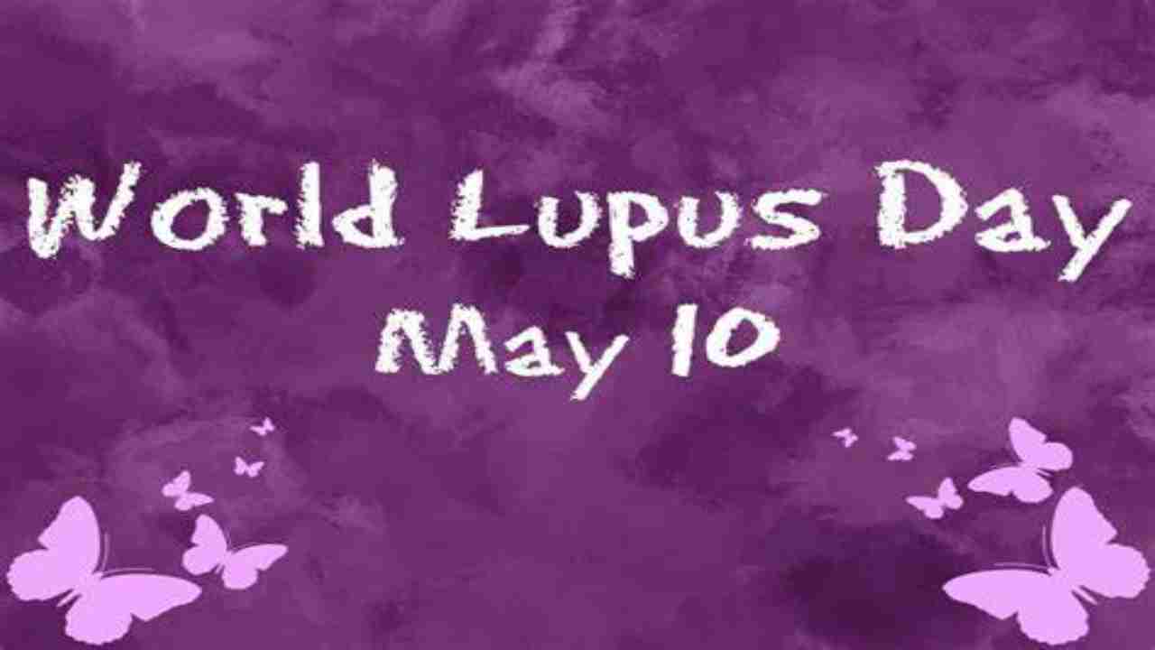 World Lupus Day 2020: Things to know about lupus, Selena Gomez and lupus
