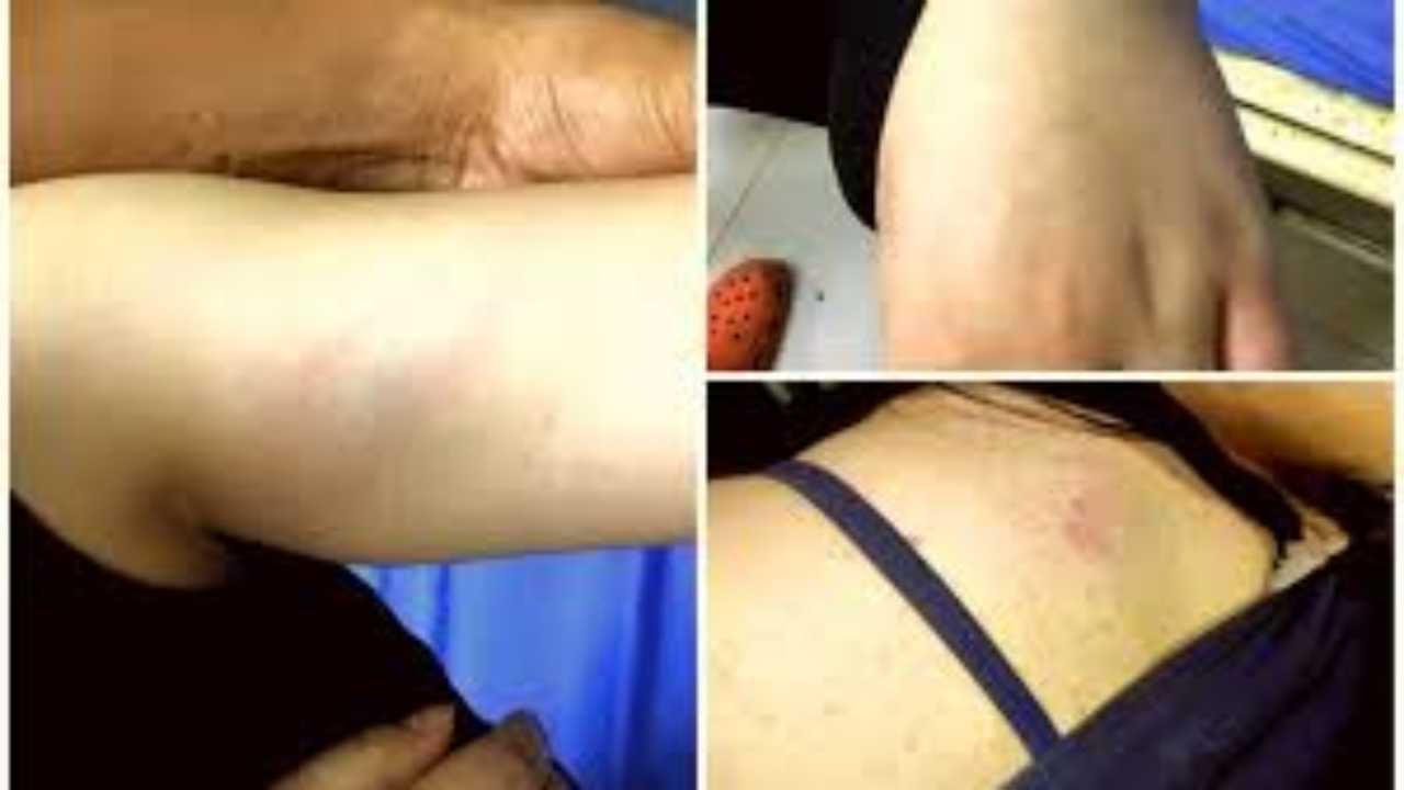 Manipur girl racially attacked, abused by locals in Gurugram; FIR registered