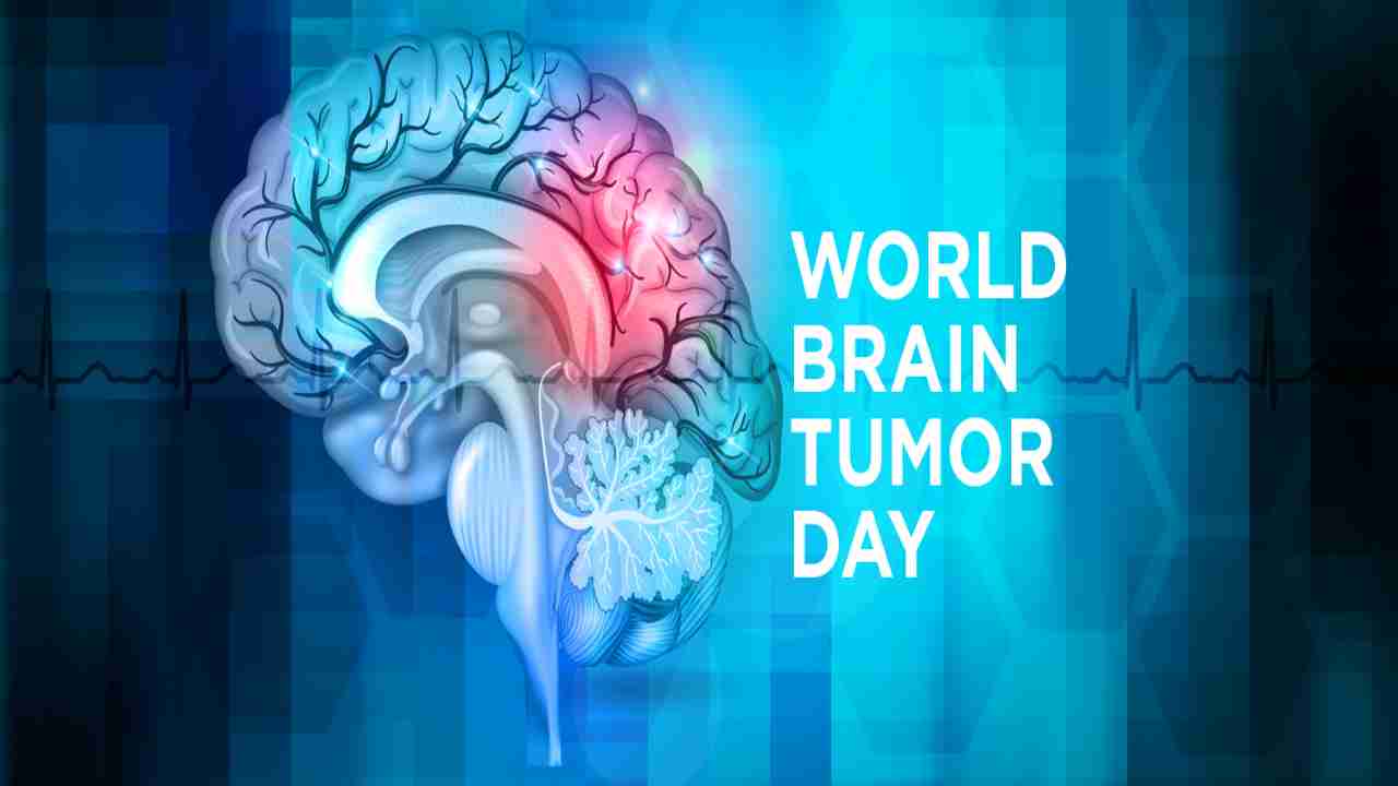 World Brain Tumor Day 2020: What is brain tumor, types, symptoms, causes, and diagosis