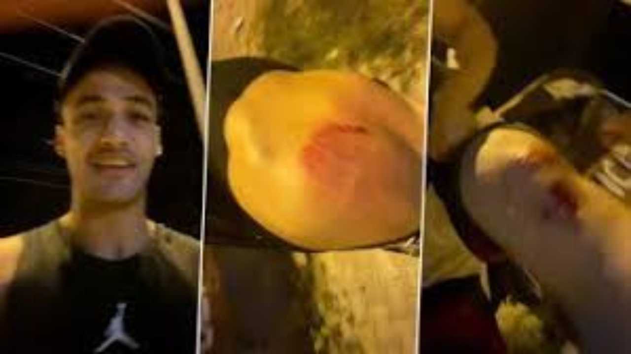 Bigg Boss 13 fame Asim Riaz gets brutally injured after attack on streets, fans trend #GetWellSoonAsim
