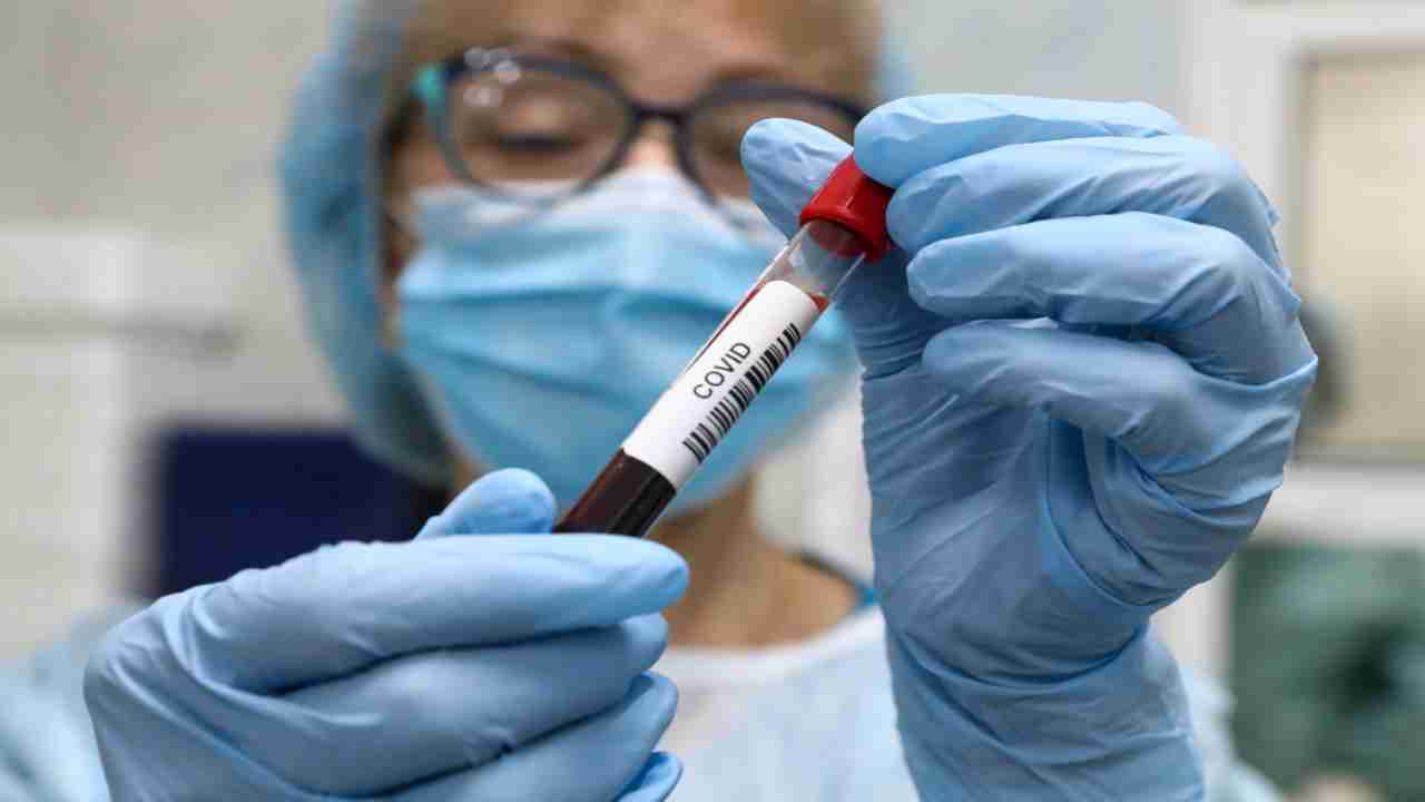 Blood test may point to patients at higher risk for Covid-19 death, say researchers