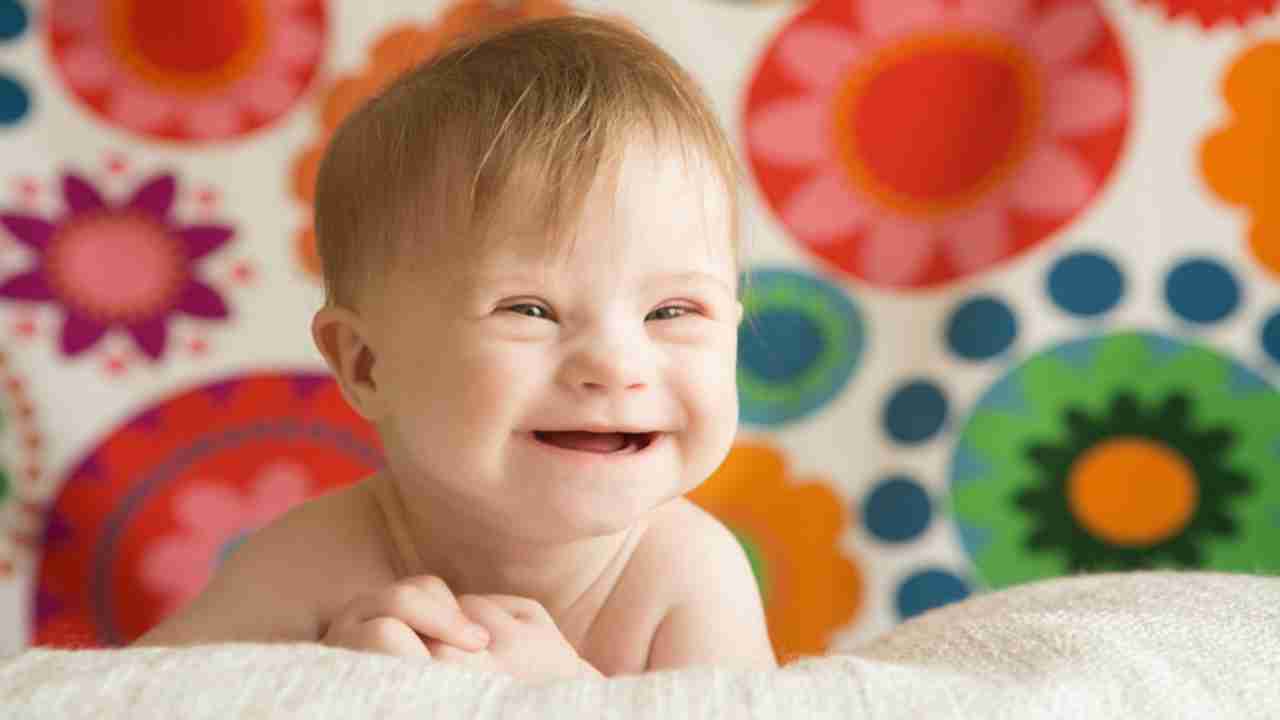 World Down Syndrome Day 2021: History, significance, all you need to know