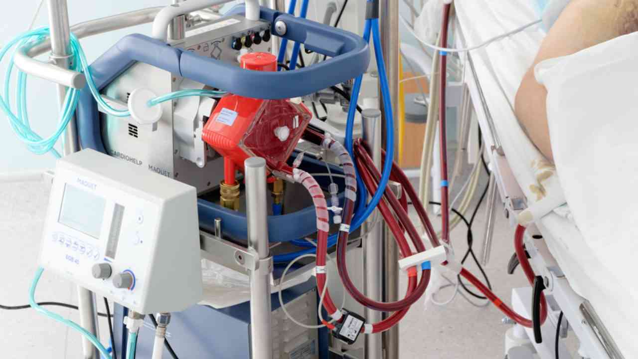 What is ECMO? Doctors are shocked so many ICU patients are on this advanced life support right now