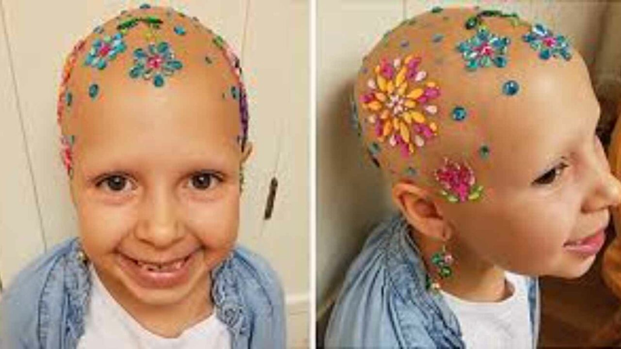 Children with Alopecia Day 2023(US): Date, History, Facts