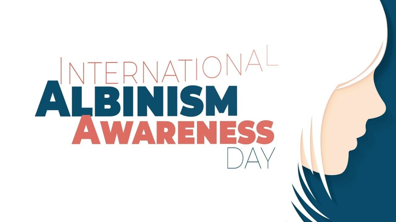 International Albinism Awareness Day 2023