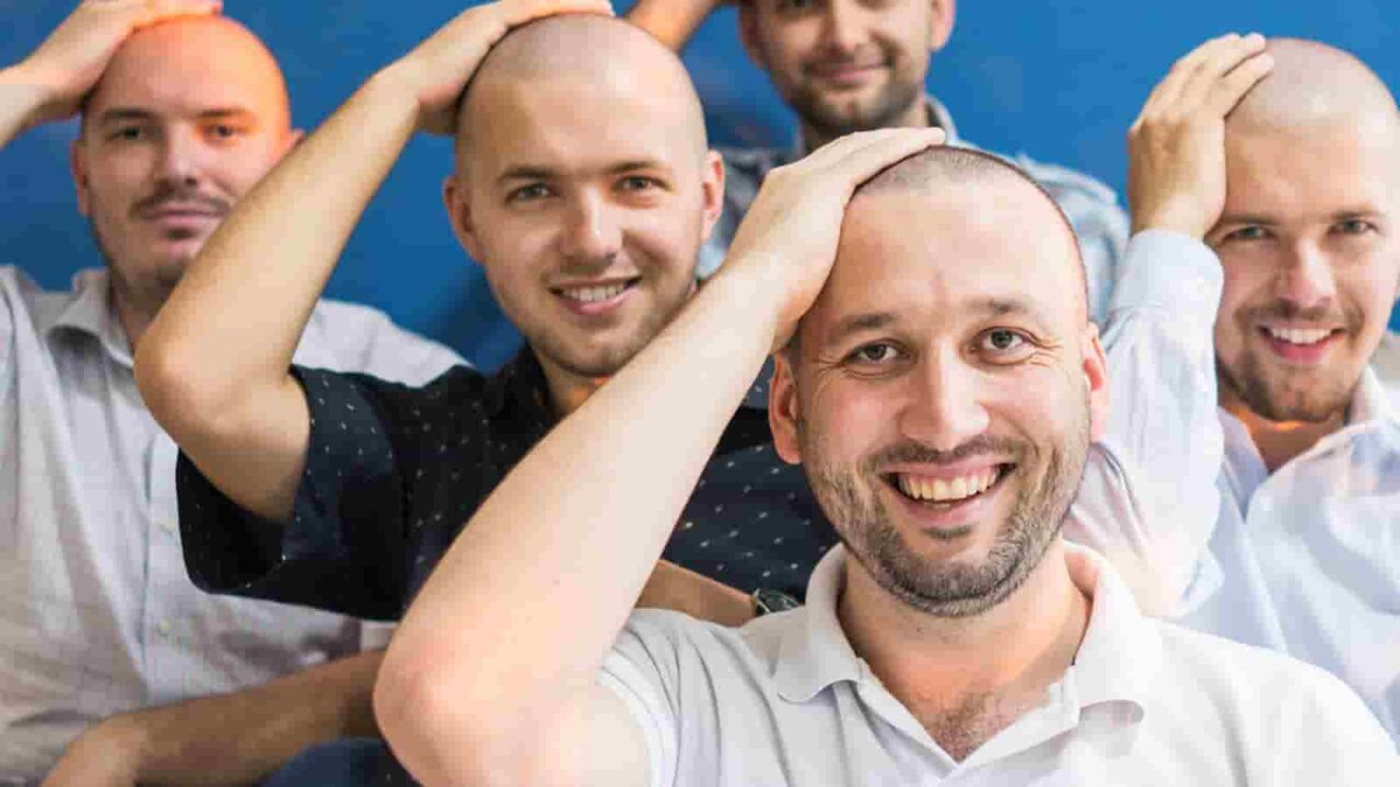 Be Bald and Be Free Day 2023 History, Activities, FAQs, and Dates