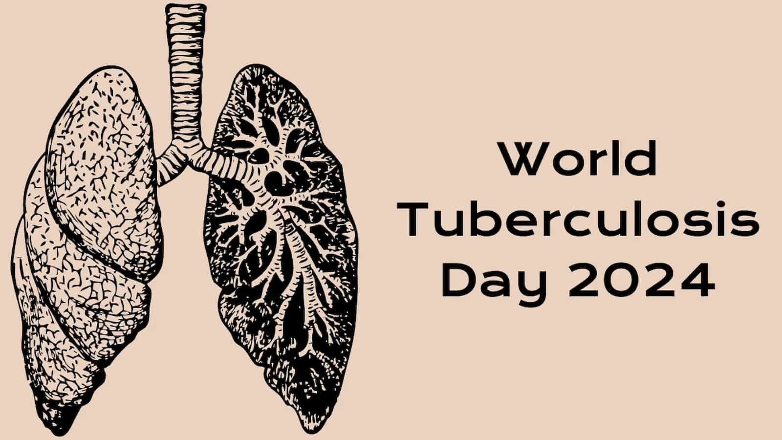 World Tuberculosis Day 2024 (US) Activities and Dates