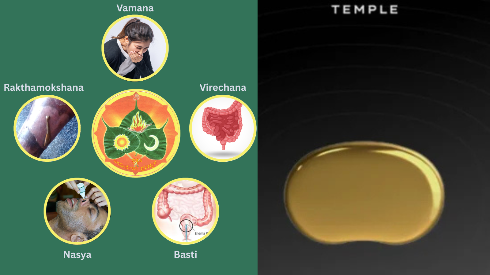 Temple Device Explained: Can Panchkarma Do More Than Expensive Longevity Wearables?