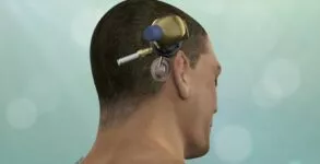 Kilpauk Keyhole Craniotomy: Chennai Doctors Introduce Safer Brain Haemorrhage Surgery